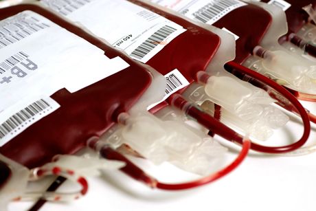 Bluttransfusion