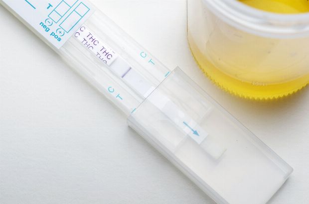 Drogentest