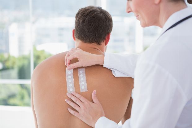 Epikutantest