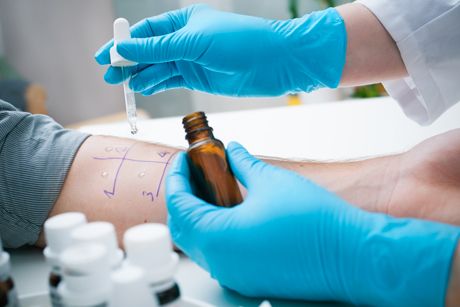 Prick-Test - Allergie-Test