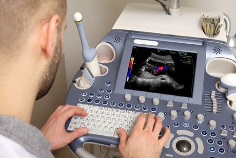 Transrektaler Ultraschall