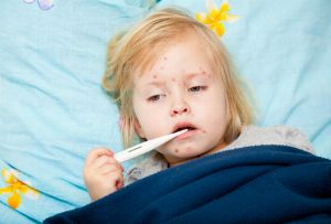 Masern: Ursachen, Symptome, Behandlung und Prävention