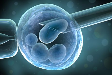 Künstliche Befruchtung