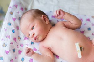 Nabelpflege bei Babys