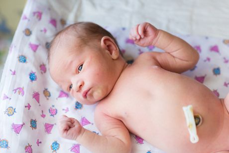 Nabelpflege bei Babys