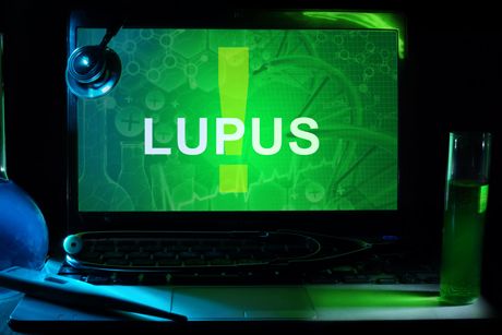 Lupus