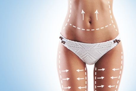 Bauch-Beine-Po: Trainingsplan für die perfekte Bikinifigur