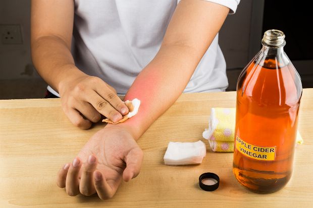 Apfelessig: Inhaltsstoffe, Wirkung und Anwendung