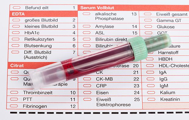 Die Bestimmung der Thrombozytenwerte im Labor erfolgt heutzutage in einem automatisierten Verfahren.