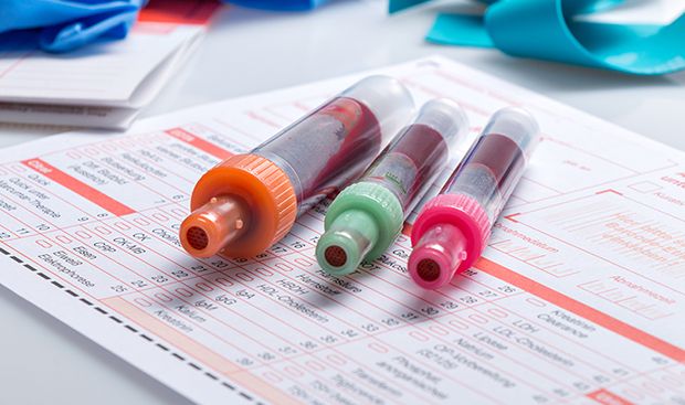 Der Immunglobulin-Wert kann Auskunft darüber geben, ob eine akute Infektion im Körper vorliegt.