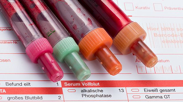 Der Lymphozyten-Wert sollte bei 1500/µl (25%) bis 3000/µl (45%) liegen.