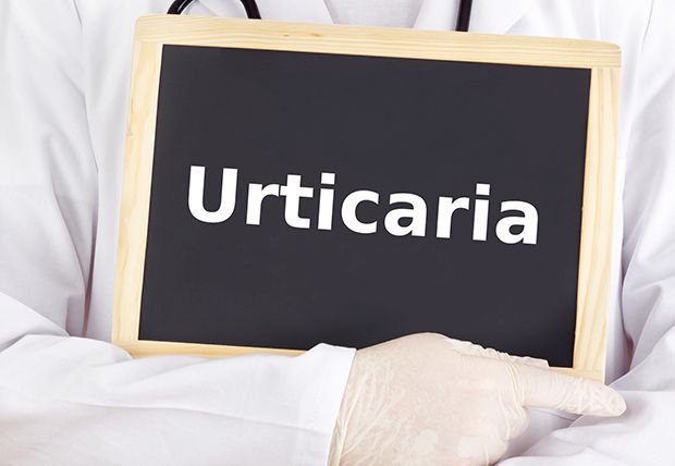 Urtikaria