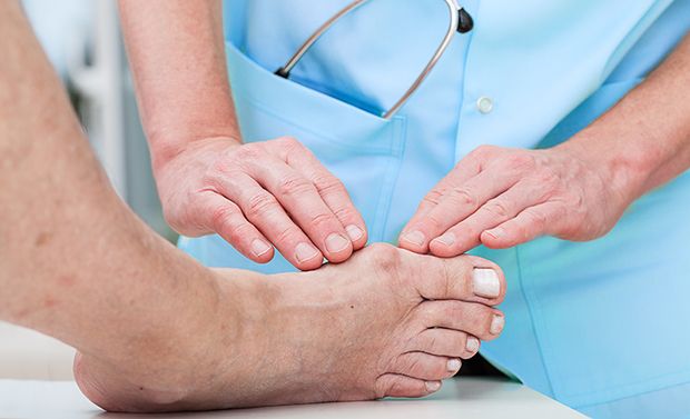 Der Hallux valgus ist die häufigste Deformität des Vorfußes. Der Hallux valgus ist die häufigste Deformität des Vorfußes.