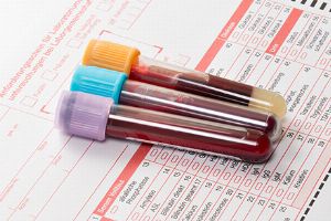 Blutwert MCH (mittleres korpuskuläres Hämoglobin)