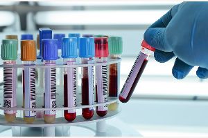 Blutwert AP - alkalische Phosphatase