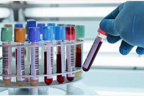 Blutwert AP - alkalische Phosphatase