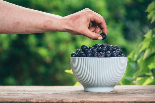 Ernährung bei Schuppenflechten