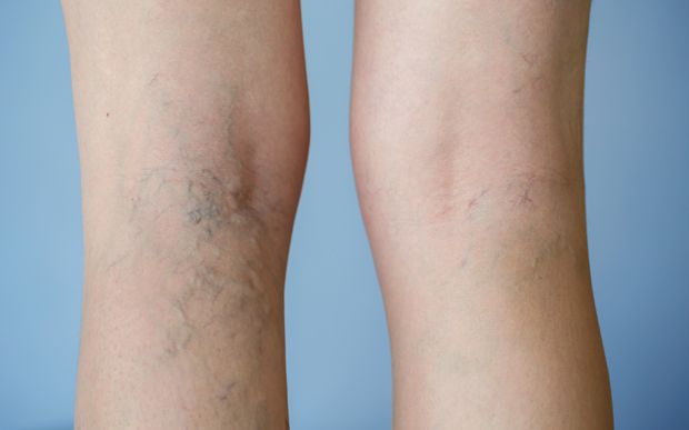 Ursachen Beinschmerzen Ursachen Beinschmerzen