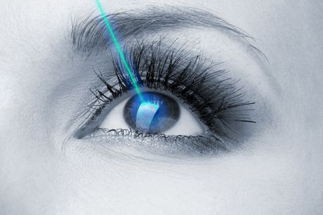 Augenlaser