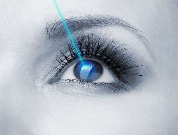 Augenlaser