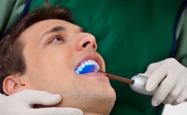 Durchführung Zahn-Bleaching Durchführung Zahn-Bleaching