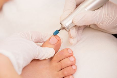 Eingewachsene Fuß- und Fingernägel