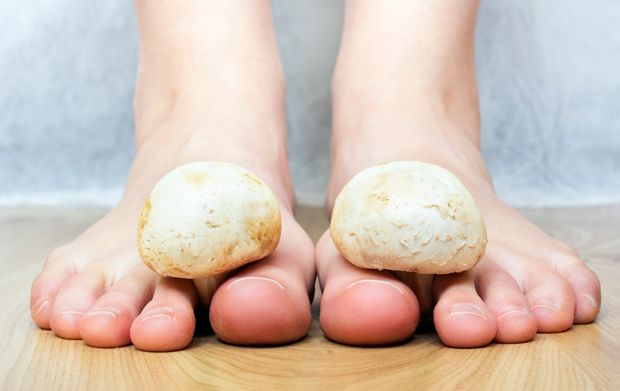3 Ways to Get Rid of Foot Fungus - wikiHow