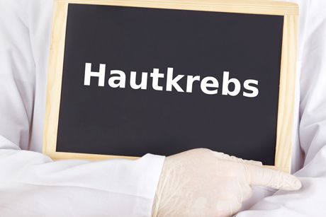 schwarzer Hautkrebs