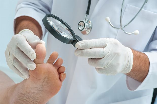Untersuchung Nagelpilz