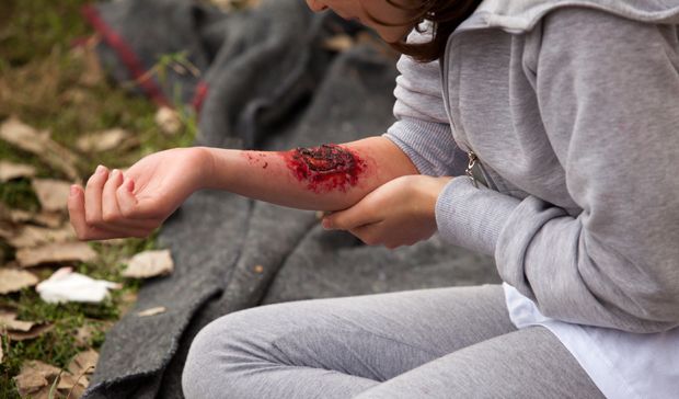 Behandlung Verbrennung