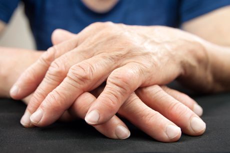 Rheumatoide Arthritis