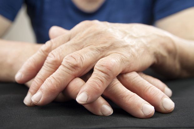 Rheumatoide Arthritis