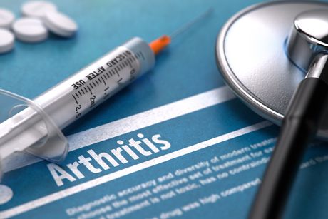 Arthritis