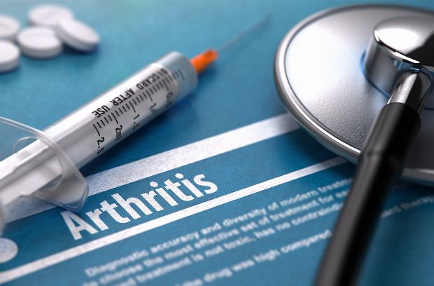 Arthritis