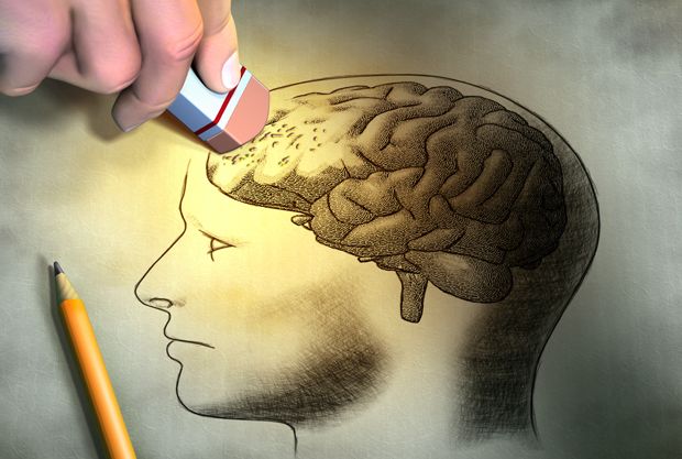 Alzheimer Alzheimer