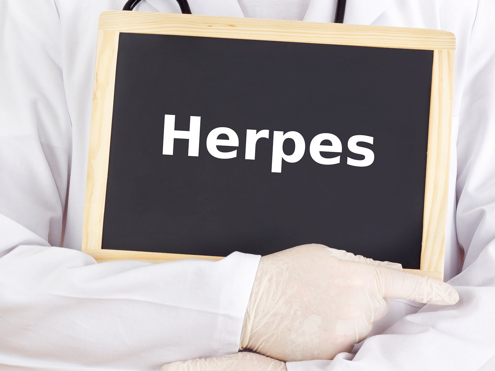 Genitaler herpes