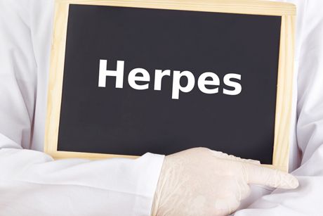 Genitaler Herpes