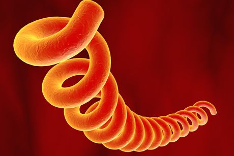 Syphilis