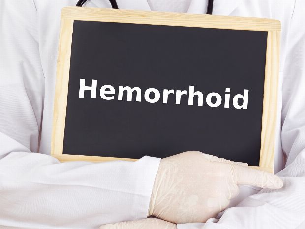 Hämorrhoiden